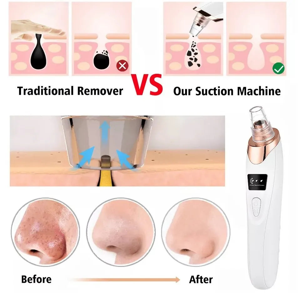 Electric Blackhead Remover – Deep Pore Cleaner for Face & Skin Care